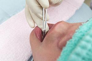 朝霞市で小児矯正を検討中の親必見!安心・信頼の治療と費用・期間のポイント