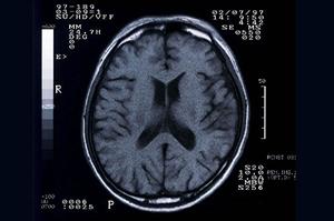 博多の矯正歯科完全ガイド2025|選ばれる理由と最新治療法を徹底解説